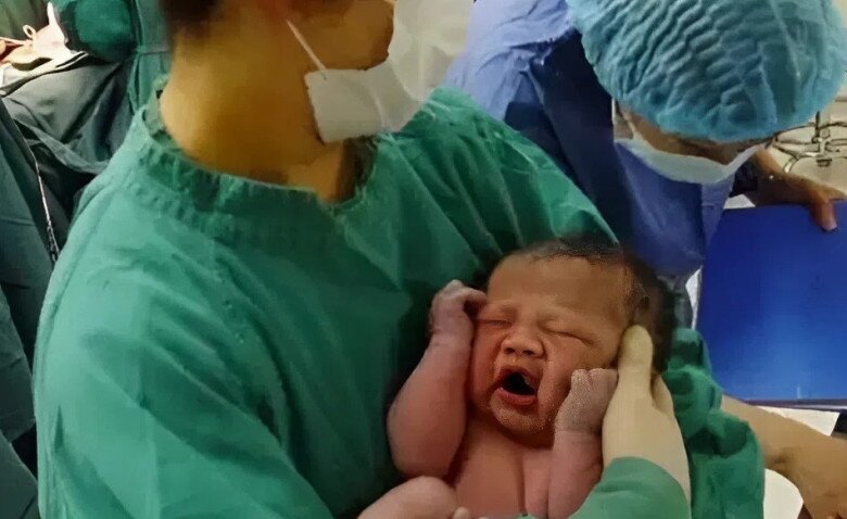 Em bé khoẻ mạnh, khóc to khi được đưa ra khỏi màng ối.