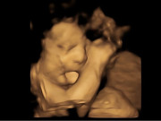 Bà bầu - Các mốc quan trọng mẹ bầu cần lưu ý trong thai kỳ