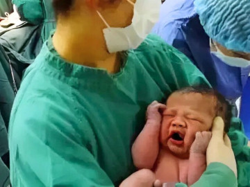 Con sinh ra ngoại hình khác lạ bố sợ không dám bế, bác sĩ đỡ đẻ lại báo tin vui: "Quá may mắn, chúc mừng gia đình"