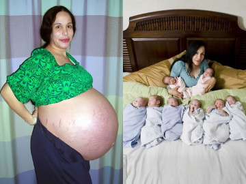 Đã sinh 6 con, người mẹ lại tiếp tục mang thai 8 bé cùng lúc, ngoại hình những đứa trẻ khi 17 tuổi mới bất ngờ