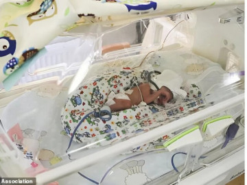 Đỡ đẻ sản phụ bầu 5 bé cùng lúc, khi đưa đủ 5 con ra khỏi bụng mẹ, bác sĩ kinh ngạc: "Tìm thấy 1 thai nhi nữa"