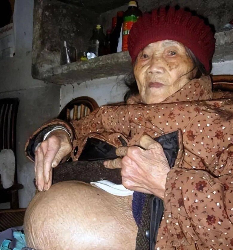 Bà lão 91 tuổi trượt chân ngã, siêu âm lại thấy thai nhi trong bụng, con trai khóc nghẹn: amp;#34;Bố tôi mất 60 năm nay rồi!amp;#34; - 4