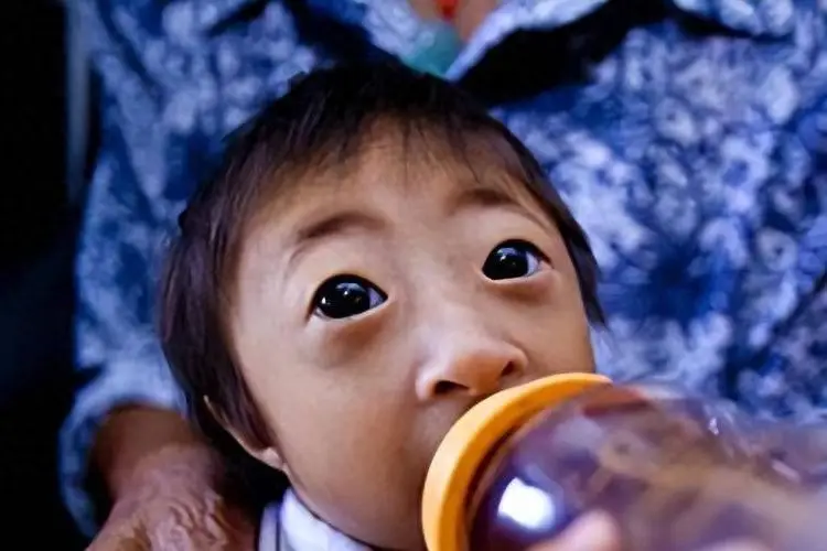 Sinh con có ngoại hình khác lạ được hỏi mua với giá 200 triệu, người mẹ nghèo quyết giữ con và hạnh phúc sau 17 năm - 4