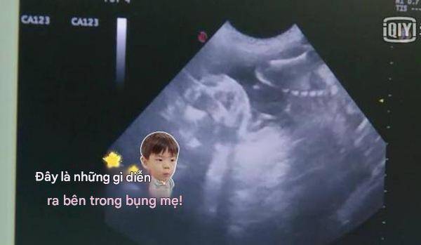 Nhìn hình ảnh siêu âm thai nhi của chú mèo, Vũ Kỳ phần nào hiểu được sự ra đời của mình.