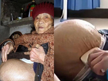 Bà lão 91 tuổi trượt chân ngã, siêu âm lại thấy thai nhi trong bụng, con trai khóc nghẹn: "Bố tôi mất 60 năm nay rồi!"