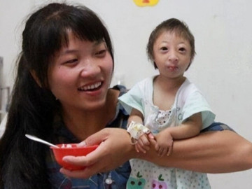 Sinh con có ngoại hình khác lạ được hỏi mua với giá 200 triệu, người mẹ nghèo quyết giữ con và hạnh phúc sau 17 năm