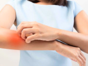 Sức khỏe - 10 triệu chứng xuất hiện trên da cảnh báo tình trạng sức khỏe có vấn đề, cần đến viện kiểm tra sớm