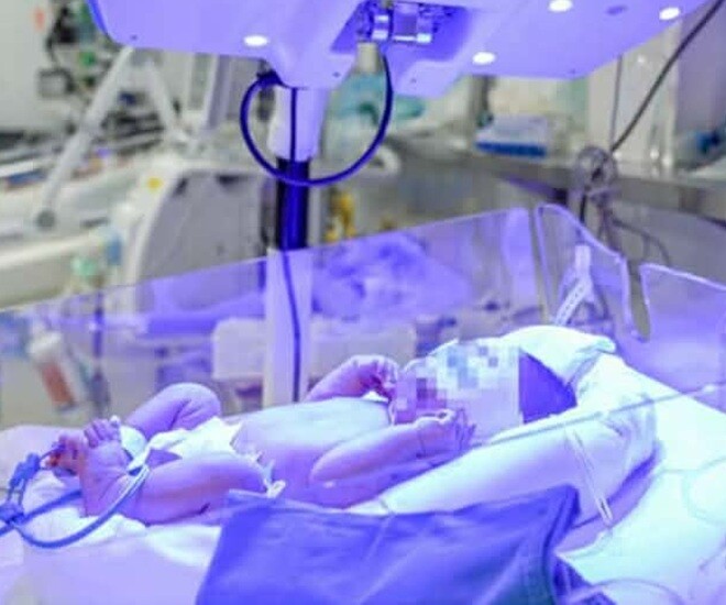 Bé trai có nhóm máu hiếm gặp và được các bác sĩ Bệnh viện Nhi Trung ương cứu sống kịp thời. Ảnh: BVCC.