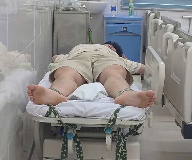 Một trường hợp bị loạn thần trong những ngày nắng nóng phải nhập viện điều trị tại Viện Sức khỏe Tâm thần. Ảnh: Lê Phương.
