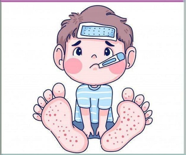 Mùa bệnh tay chân miệng đang đến, làm ngay điều này để bảo vệ bé khỏe mạnh - 1