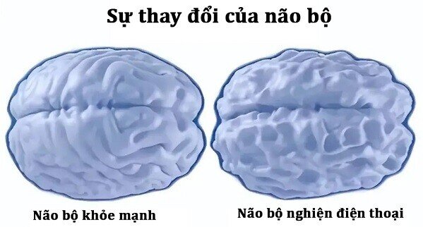 Não bộ trẻ amp;#34;nghiệnamp;#34; điện thoại và trẻ không chơi điện thoại âm thầm thay đổi, khác biệt lớn sau 10 năm - 5