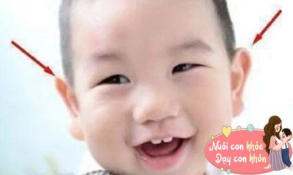 Các nhà khoa học cho biết, khi trẻ sơ sinh có đôi tai cao hơn thì chứng tỏ thính giác nhạy hơn.