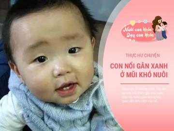 Thực hư chuyện trẻ nổi gân xanh ở mũi sẽ khó nuôi, khoa học giải thích