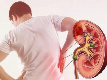 Dấu hiệu cảnh báo suy thận: Đi bộ thấy biểu hiện này cần đặc biệt lưu ý