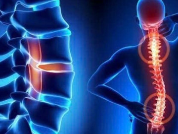 Sức khỏe - Sáng cứng cổ, chiều mỏi lưng: Khi đau cột sống trở thành vấn đề cần chăm sóc lâu dài