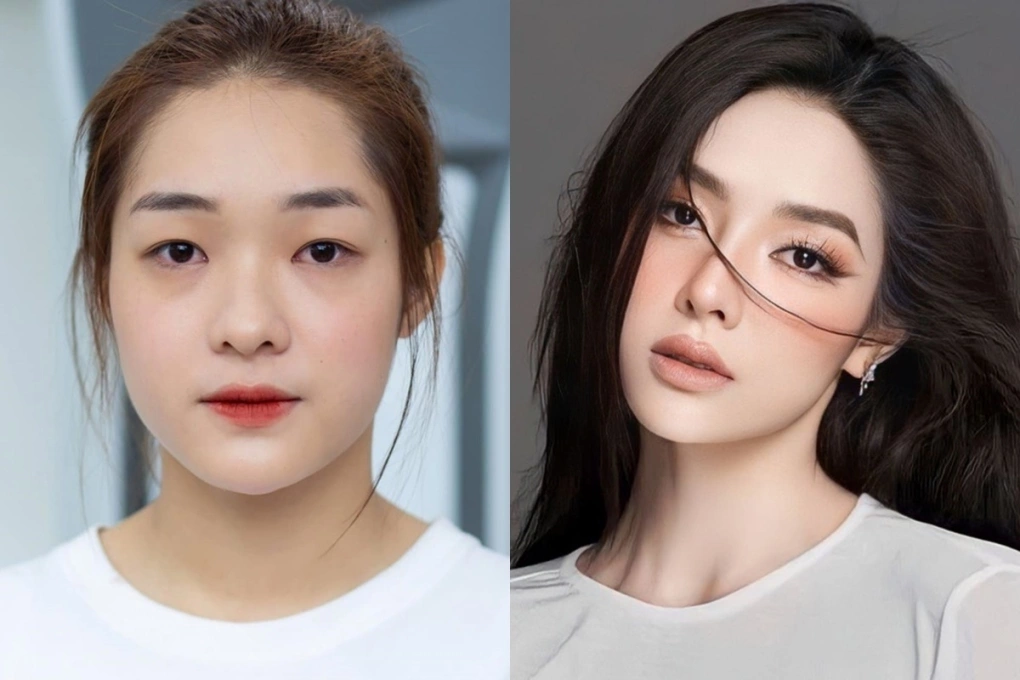 Hồng Hạnh từng thẳng thắn thừa nhận bản thân đã dao kéo vì tự ti về ngoại hình.