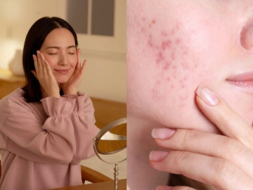 Đẹp - Tưởng chăm da kỹ, ai ngờ 5 thói quen này lại khiến lỗ chân lông nở to, da xuống cấp nhanh chóng