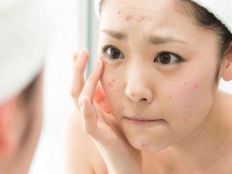 Cô gái mang túi mỹ phẩm mua online đến cầu cứu bác sĩ vì mặt bị dị ứng sau vài lần sử dụng