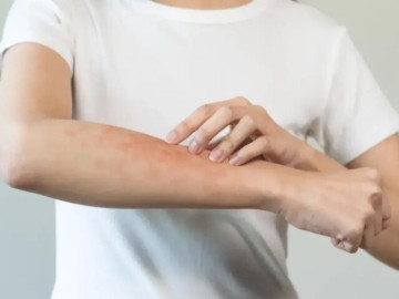 Sức khỏe - Trời nắng nóng kèm mưa ẩm, đây là tác nhân gây hại sức khỏe cả nhà nhưng rất khó tiêu diệt