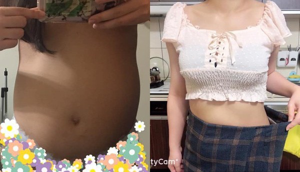 5 năm bụng to nhưng không biết, cô gái 22 tuổi đi khám thì ân hận khi bác sĩ nói khó có con - 3