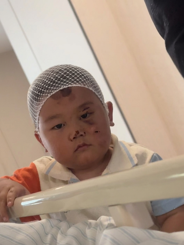 Bé trai 3 tuổi mặt đầy vết thương túc trực chăm mẹ nằm giường bệnh, câu chuyện phía sau ai nghe cũng nghẹn lòng - 1