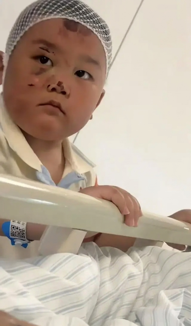 Bé trai 3 tuổi mặt đầy vết thương túc trực chăm mẹ nằm giường bệnh, câu chuyện phía sau ai nghe cũng nghẹn lòng - 2