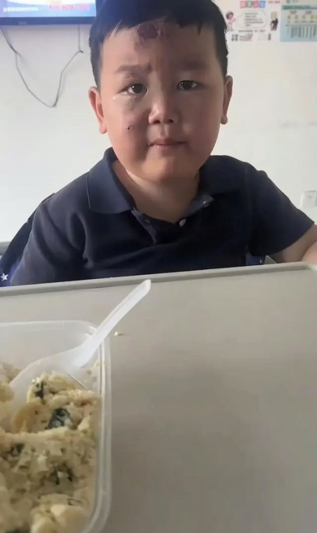 Bé trai 3 tuổi mặt đầy vết thương túc trực chăm mẹ nằm giường bệnh, câu chuyện phía sau ai nghe cũng nghẹn lòng - 3