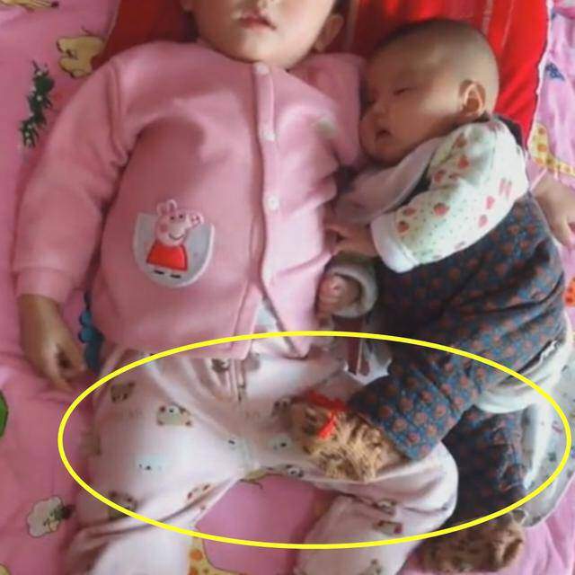 Cho con sơ sinh ngủ cùng con lớn, khi giở chăn ra người mẹ gọi chồng đến ngay lập tức - 2