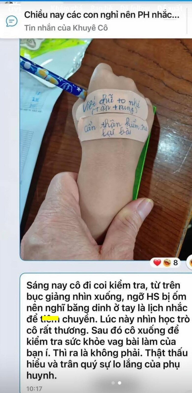 Con tiểu học đi thi, mẹ Việt lấy băng y tế dán đầy tay bé, cô giáo phát hiện dòng chữ xúc động nhắn nhóm lớp - 1