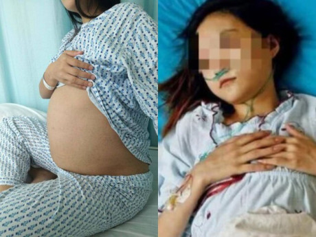 Bà bầu - Nữ sinh đau bụng kinh liền đến bệnh viện khám, vừa cởi đồ bác sĩ hốt hoảng thấy đầu thai nhi sắp ra