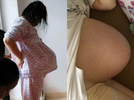 Người phụ nữ mang thai đôi, khoe bụng bầu có hình dáng nhọn hoắt khiến CĐM kinh ngạc, không ngừng xôn xao