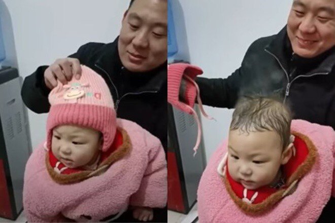Gửi con về nhà nội, mẹ bỉm đi làm về thì tá hỏa khi thấy hiện tượng đầu con 3 tuổi amp;#34;bốc khóiamp;#34; - 1