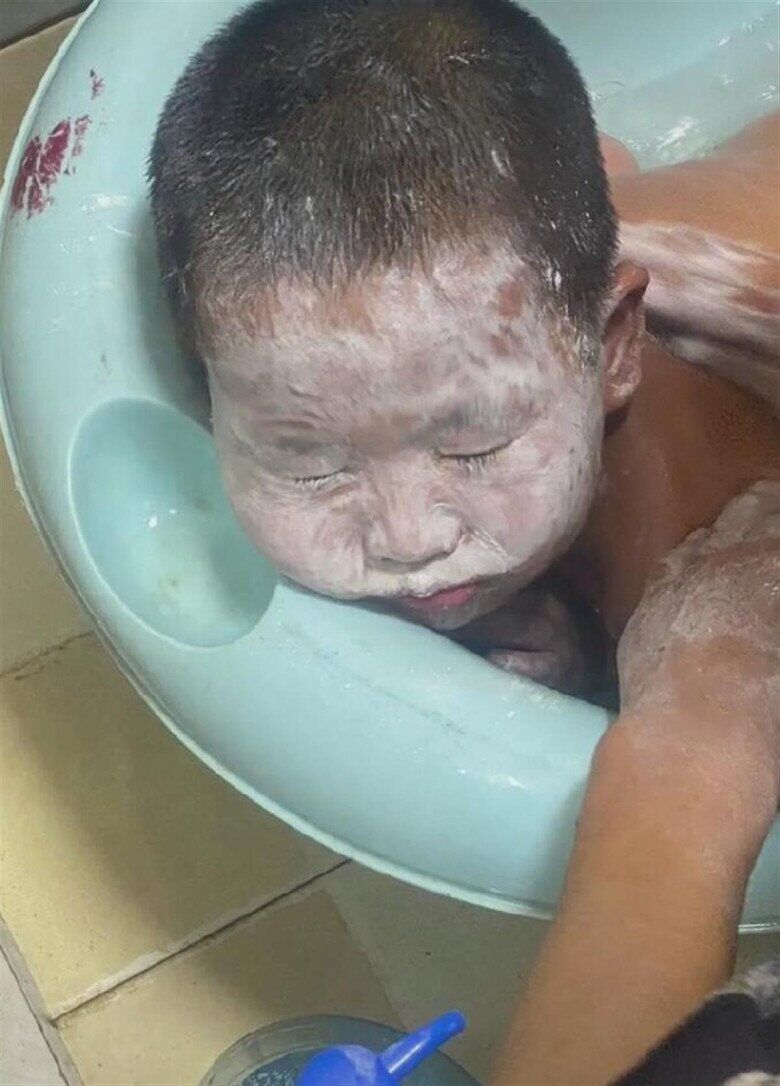Mẹ phát hiện con trai đi tắm mãi vẫn chưa ra, vào kiểm tra thì hoảng hốt thấy mặt con trắng bệch - 1