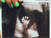 Bà bầu - Mẹ bầu đi siêu âm thai, ngạc nhiên thấy em bé trong bụng giơ bàn tay 5 ngón, nghe bác sĩ nói liền xúc động