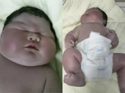 Bà bầu - Chào đời nặng 13kg, da tím tái, bé sơ sinh khiến bác sĩ phải thốt lên: "Chưa từng thấy"