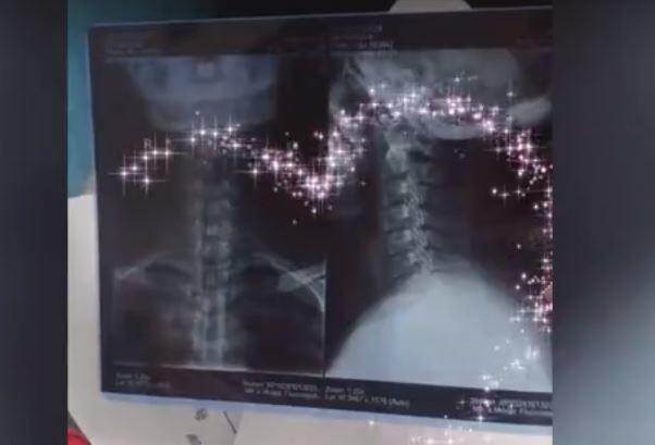 May là kết quả kiểm tra cho thấy bà nội không gặp vấn đề gì nghiêm trọng.