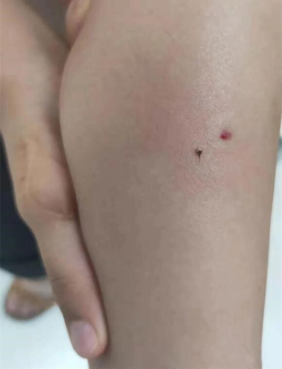 Vừa nghỉ hè cuối tuần về chơi với ông bà ở quê, bé trai khiến mẹ phát hoảng với gương mặt biến dạng - 2