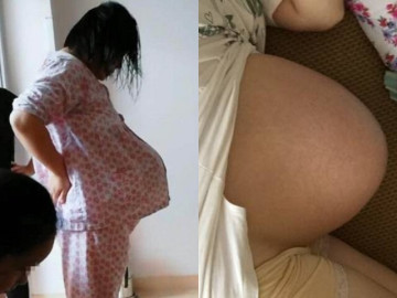 Bà bầu - Người phụ nữ mang thai đôi, khoe bụng bầu có hình dáng nhọn hoắt khiến CĐM kinh ngạc, không ngừng xôn xao