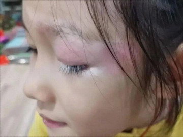 Yêu con - Con gái xinh xắn bỗng mọc lông mi màu trắng kỳ lạ, mẹ hoang mang đưa đến bệnh viện khám, bác sĩ lắc đầu