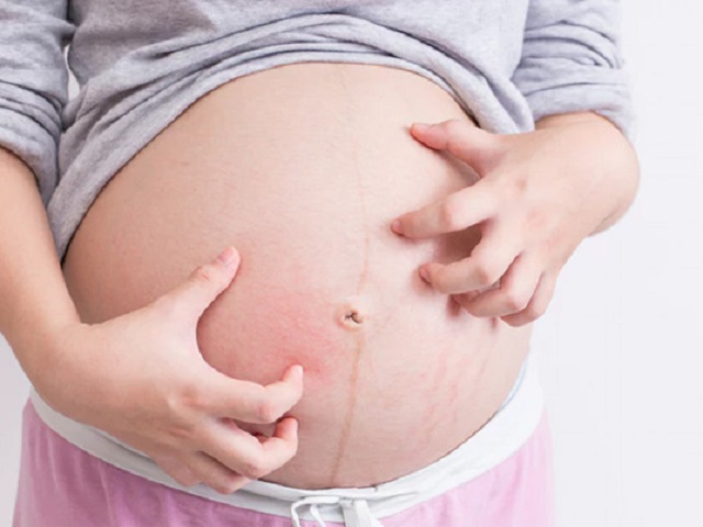 Cách trị ngứa khi mang thai đơn giản lại hiệu quả ngay tại nhà - 1