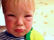 Tin tức - Mẹ vừa nhuộm tóc, con trai 2 tuổi bị mù mắt tạm thời sau 20 phút ôm mẹ ngủ