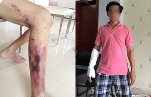 Từ vụ bé 2 tuổi bỏng toàn thân vì chất thông bồn cầu: Cẩn trọng mất tiền mua rồi lại amp;#34;tự hạiamp;#34; chính mình - 2
