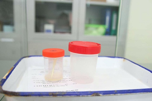 Hành trình đi hiến và bảo quản tinh trùng được diễn ra như thế nào? - 3