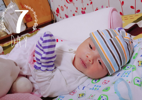 Chuyện đẻ mổ chân thực từng chi tiết nhưng chẳng hề đáng sợ như tưởng tượng của mẹ 9x - 4