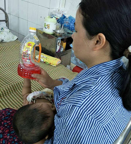 Nhầm chai dầu hỏa là nước ngọt, bé 16 tháng tuổi bị ngộ độc phải nhập viện cấp cứu - 1