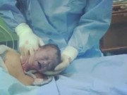 Tin tức - Nín thở xem khoảnh khắc em bé bất ngờ tự bật ra khỏi bụng mẹ trong ca sinh mổ ở Hà Nội
