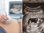 Bà bầu - Từng khóc hết nước mắt khi siêu âm thai dị tật, người mẹ không ngờ con chào đời lại thế này!