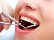 Tin tức - Suýt chết vì sốc phản vệ khi nhổ răng