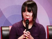 Tin tức - Cô gái bị chồng tẩm xăng đốt: "Không trách chồng chỉ trách mình bước vào hôn nhân quá sớm"