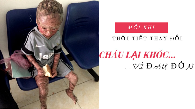 Mắc bệnh lạ bị mẹ bỏ rơi lúc mới sinh, 9 năm bé trai sống với người vừa làm ông vừa làm mẹ - 2